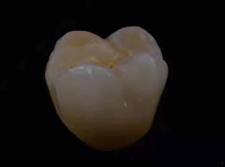 HPP crown 1